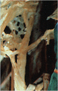 The Fungus