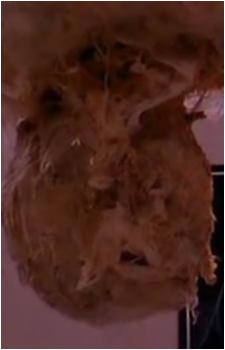 The Fungus