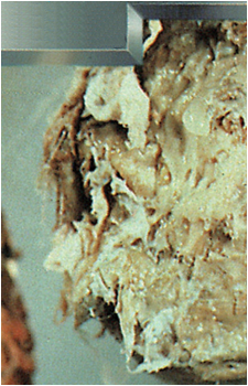 The Fungus