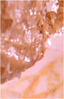 The Fungus