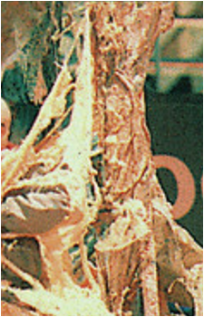 The Fungus