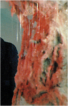 The Fungus