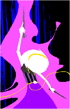 Rose Lalonde