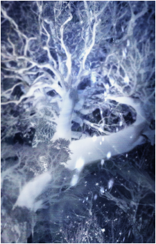 The Snowing Tree's image