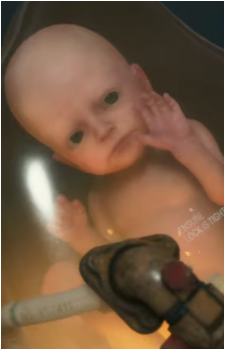 Lou's image