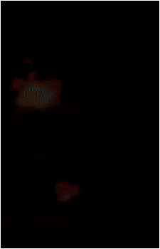 Zetterburn